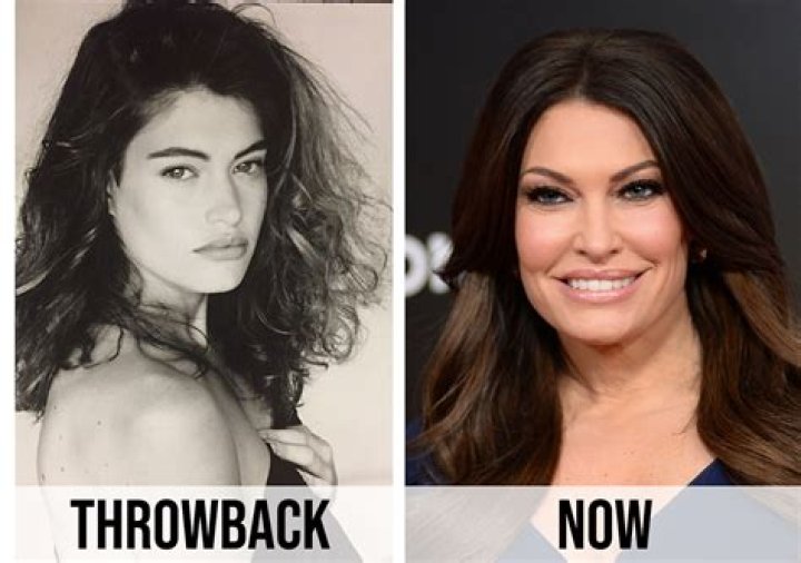 Exploring Kim Guilfoyle's Botox Journey: Beauty, Confidence, And Controversy
