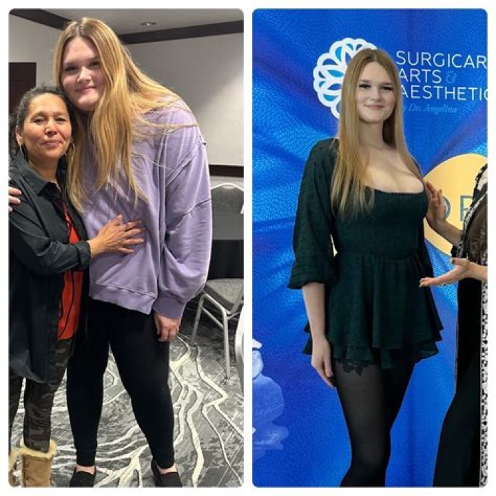 Kimberly Guilfoyle's Ozempic Transformation: Before And After Reveal
