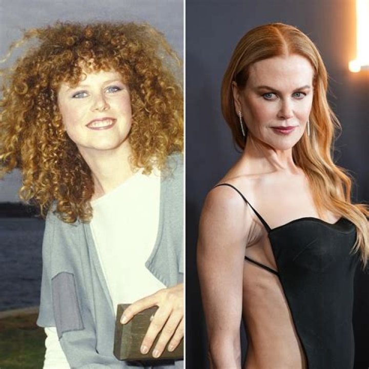 Nicole Kidman: The Controversy Surrounding Her Plastic Surgery Choices