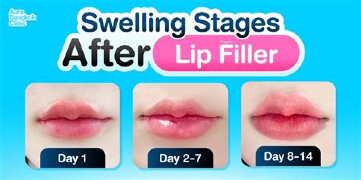 Rowan Blanchard And The Lip Filler Debate: What's The Truth?