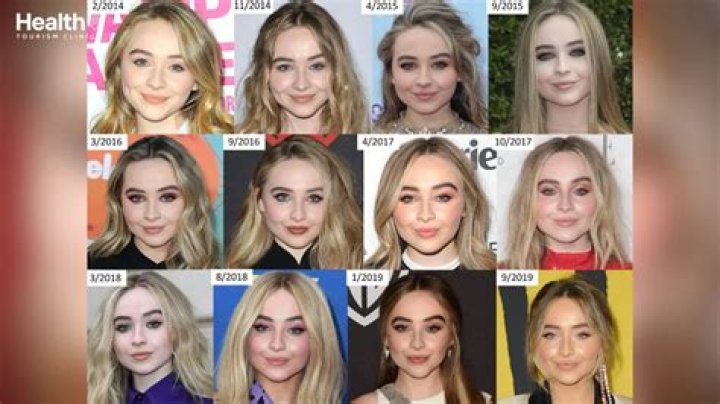 Sabrina Carpenter's Journey: Exploring The Rumors Of Facial Surgery