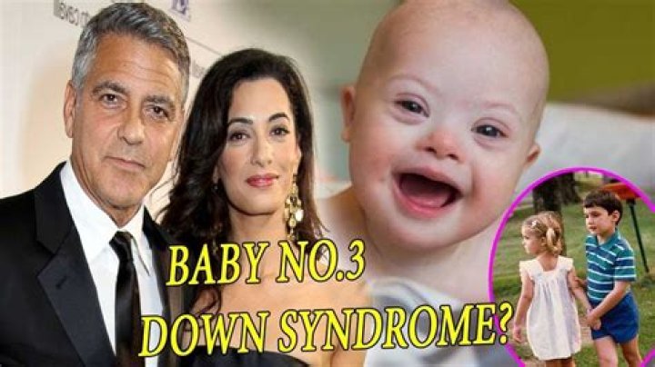 Understanding The Clooney Twins And Down Syndrome: A Heartfelt Exploration