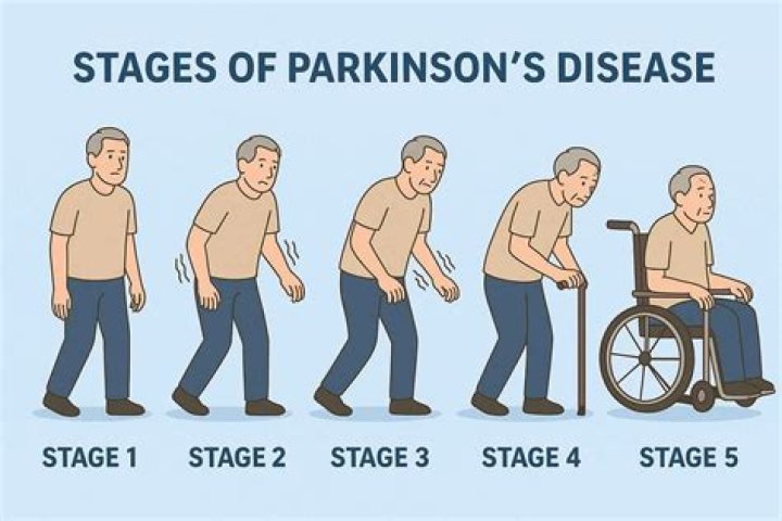 Unraveling The Truth: Does Keanu Reeves Have Parkinson's Disease?
