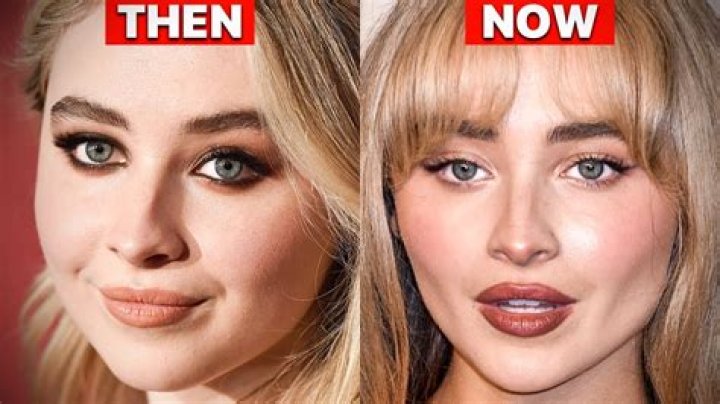 Unveiling The Truth: Did Sabrina Have Plastic Surgery?